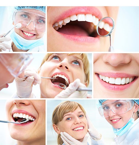 My Skills: Teeth Whitening Kits